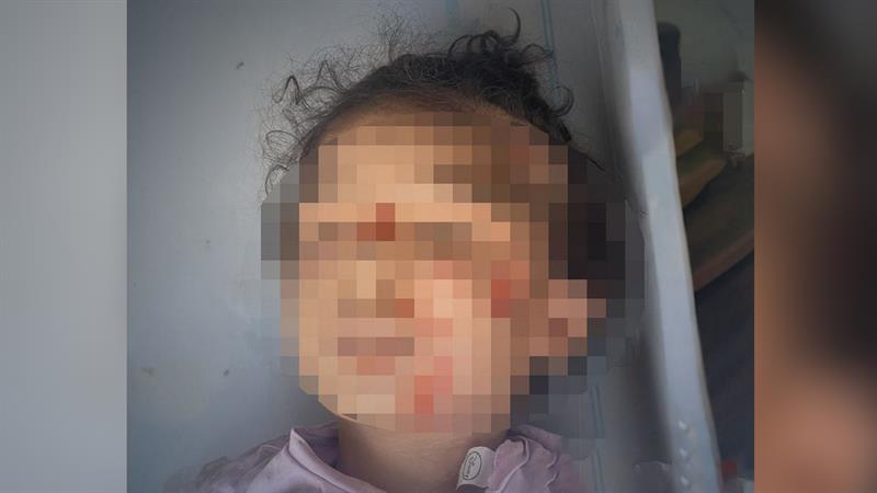 مقتل طفلة في بغداد عنفها والدها حتى الموت 