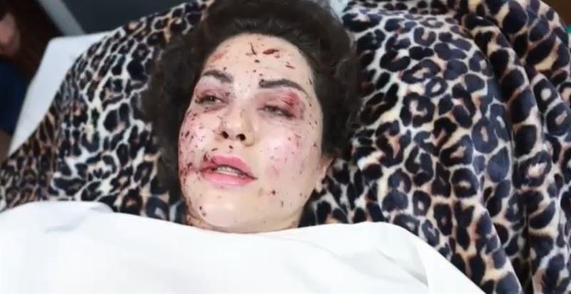 بالفيديو.. زوجة بيشرو دزيي تروي تفاصيل الهجوم الإيراني على منزلهم في أربيل
