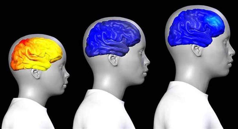 المراهقة والشيخوخة.. الدماغ وتغيراته في مراحل العمر المختلفة
