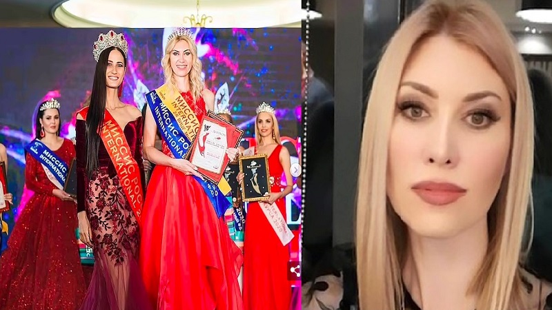 صور: ملكة جمال روسيا تفقد القدرة على إغلاق عينيها بسبب عملية تجميل فاشلة  