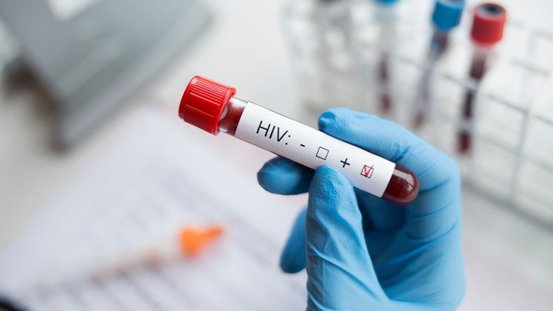 ئەمساڵ ٨٧ حاڵەتی نوێی ئایدز لە هەرێم تۆمارکراوە