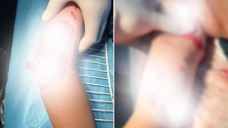 لە هەولێر منداڵێک پڵنگ پەلاماریدا و بریندارە

